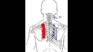 견갑골 내측연 자가촉진 능형근 통증에서 자유하자 스텔론코치amp희범군 [upl. by Cone353]