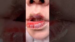 Solved dry lips problems easily at homeviralvideo shorts lips winter [upl. by Goldia]