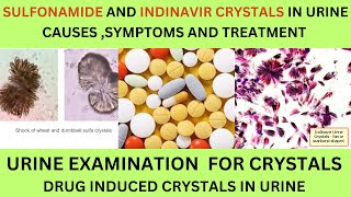 SULFONAMIDE AND INDINAVIR CRYSTALS IN URINECAUSES SYMPTOMS AND TREATMENT OF SULFONAMIDE CRYSTALS [upl. by Chretien]