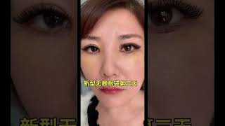 Remove eye bags and lift eyebrows [upl. by Tehc]