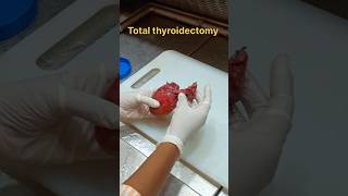 Total thyroidectomy specimen 😳 [upl. by Pharaoh318]