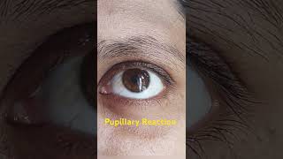 Pupillary reaction in eye [upl. by Mandi]