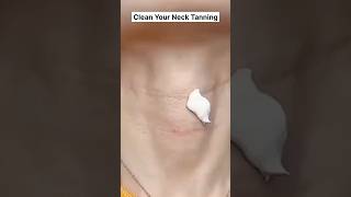 Remove Dark Neck Home Remedy  Neck Whitening Tips  Get Rid of Dark Neck [upl. by Darraj991]