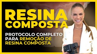 Resina Composta  Protocolo completo para remoção de Resina Composta Atualizado 2024 [upl. by Yelrahs37]