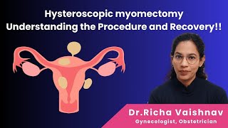 Hysteroscopic myomectomy  Understanding the Procedure and Recovery  Dr Richa Vaishnav [upl. by Nnyladnarb]