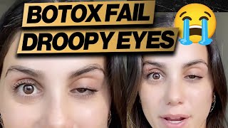 Botox Gone Wrong Droopy Eye  Cheap Fix [upl. by Robers]