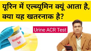 Urine Albuminuria Causes and its Treatment  Microalbumin  ACR test  Normal Range Explained [upl. by Ardnot]