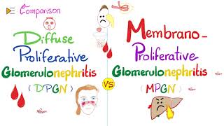 Diffuse Proliferative Glomerulonephritis vs Membranoproliferative Glomerulonephritis  DPGN vs MPGN [upl. by Jeremy]