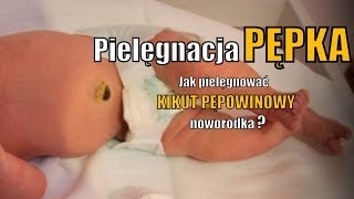 Pielęgnacja pępka i kikuta pępowinowego [upl. by Purdy]