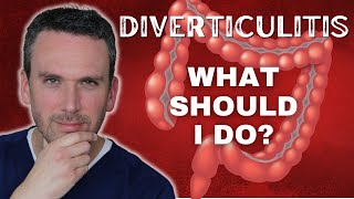 What to do AFTER DIVERTICULITIS [upl. by Mitchel]