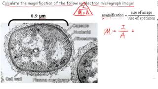 Calculating Magnification IB Biology [upl. by Annais4]