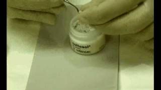 Applying Coltosol Temporary ZincOxide cement [upl. by Ynos]