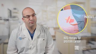 HIFU Treatment for Prostate Cancer  Dr Ahmed Aly Hussein [upl. by Aihsotal24]