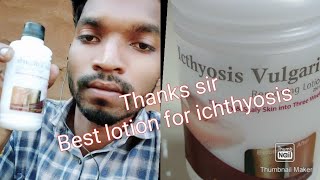 Icthyosis vulgaris removing lotion bhupendra gamit Gujarat [upl. by Thorny686]