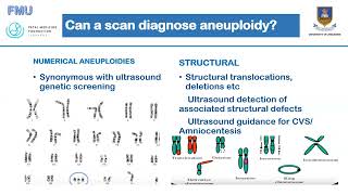 Aneuploidy Screening Dr C Chirume [upl. by Soble]