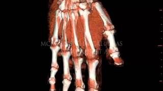 Animation of the hand muscles and tendons with dissolving layers [upl. by Balough918]