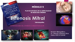 Estenosis Mitral EM [upl. by Tedi623]