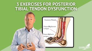 3 Exercises for Posterior Tibial Tendon Dysfunction [upl. by Christi]