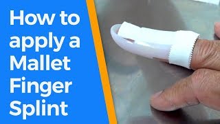 How to apply a Mallet Finger Splint [upl. by Meehar]