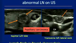 Thyroid Ultrasound Course [upl. by Esilenna]