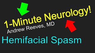 1Minute Neurology Hemifacial Spasm [upl. by Tine192]