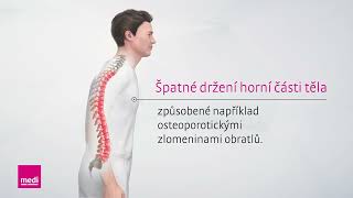 Spinomed® – princip biologické zpětné vazby [upl. by Gnort501]