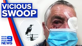 Man undergoes surgery after vicious magpie attack  9 News Australia [upl. by Ociram]