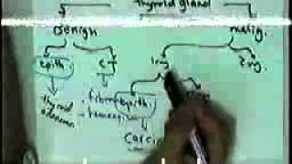 SYSTEMIC PATHOLOGY endocrine 2 DR SAMEH GHAZY [upl. by Argyres]