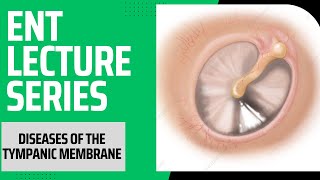 Diseases of the tympanic membrane  Ear drum pathology  ENT Lecture Series  Lecture 2 [upl. by Aserehc]