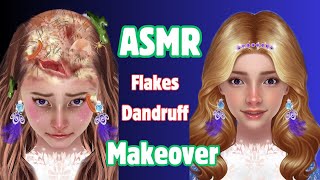 Big flakes dandruff ASMR makeover animation [upl. by Undine]