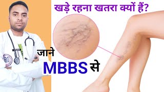 खड़े रहना खतरा क्यों होता हैं whats varicose vein disease varicoseveinanatomy raheesansari [upl. by Aslin]