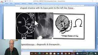 Intestinal disorders in Arabic 10  Volvulus  part 2   by Dr Wahdan [upl. by Abixah794]