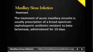 Maxillary sinus infection Maxillary sinus [upl. by Llenroc]