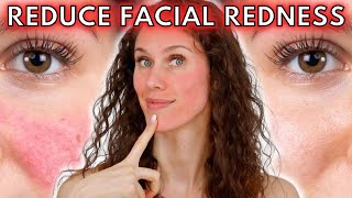 🔴 5 Reasons Your Face Is Always Red Rosacea to Dermatographia amp Everything Inbetween [upl. by Airretal842]