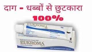 How To Remove Melasma  Hyperpigmentation  Eukroma cream uses sideeffects price review in hind [upl. by Oeak558]