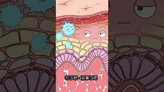 银屑病 parapsoriasis guttata animation [upl. by Couchman]