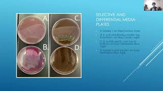 Testing For Antibiotic Producing Bacteria Extracted from Soil [upl. by Jesher1]