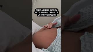 Como fica a barriga pósparto [upl. by Lirrad]