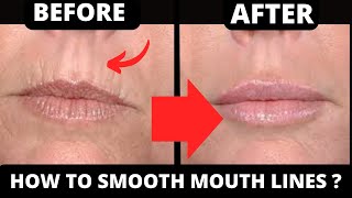 HOW TO GET RID OF WRINKLES  HOW TO GET RID OF WRINKLES AROUND MOUTH  LIPS LINES  FACE YOGA [upl. by Hildebrandt]