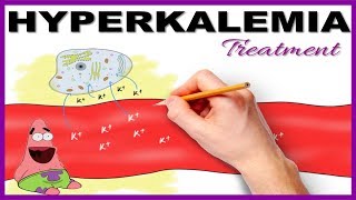 Hyperkalemia with ECG changes Treatment  Mnemonic Series 15 [upl. by Gasperoni]