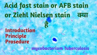 acid fast staining procedure and principle in Hindi  ZN stain  AFB stain [upl. by Tamsky]