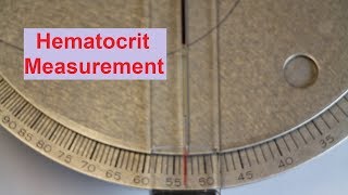 Hematocrit Measurement [upl. by Leynad]