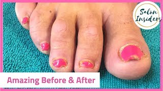 Pedicure Tutorial Toe Nail Reconstruction [upl. by Aurthur]