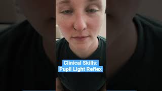 Pupil Light Reflex Clinical Skills  LevelUpRN [upl. by Yelmene]