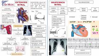 3 ESTENOSIS Y INSUFICIENCIA AORTICA [upl. by Mallory]