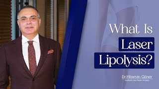 What Is Laser Lipolysis  Hüseyin Güner [upl. by Ordnasela]