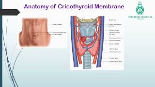 Cricothyroidotomy [upl. by Leffert464]