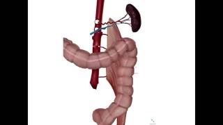 A Complicated Case of Splenic Injury after Colonoscopy [upl. by Nitin]