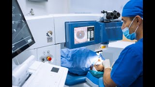 Prednosti SmartFEMTO LASIK procedure laserskog skidanja dioptrije [upl. by Oriel]