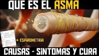 QUE ES EL ASMA ANIMACION  CAUSAS SINTOMAS Y TRATAMIENTO [upl. by Ching]